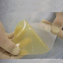 High Quality Hydrocolloid Wound Dressing for Single Use